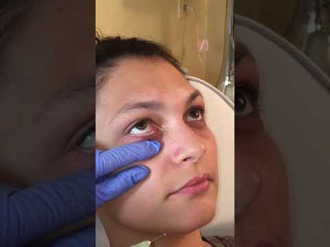 hqdefault (3) hqdefault 3 Med Spa Videos