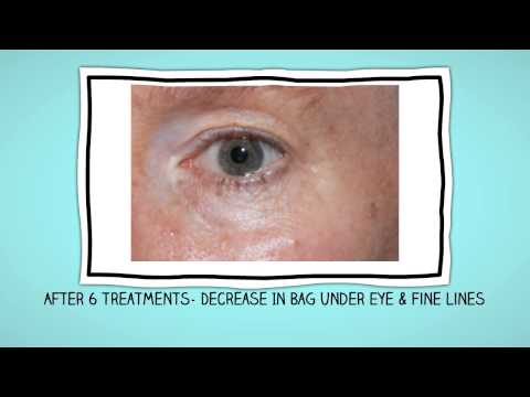 hqdefault (8) hqdefault 8 Med Spa Videos